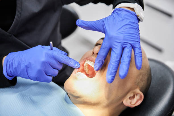 Best Emergency Wisdom Tooth Extraction in Dove Valley, CO
